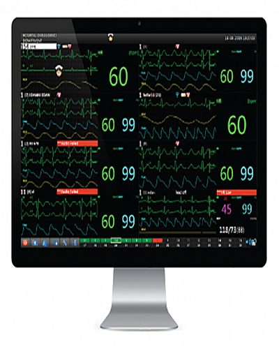 Central Monitoring System